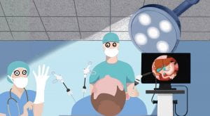 Cartoon image of surgeon performing gallbladder removal surgery